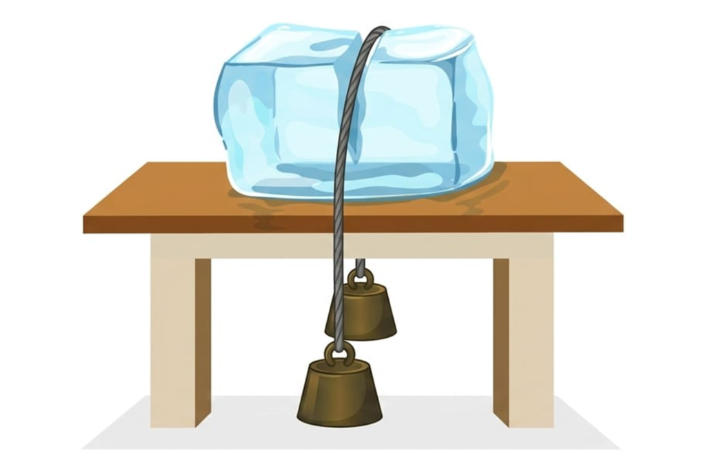 Ksharasutra medicated thread placed in pilonidal sinus tract at Proctosafe Clinic Kolkata